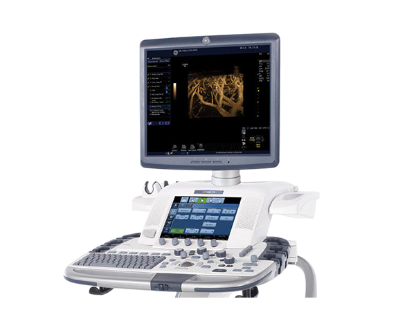 GE HealthCare LOGIQ 초음파 시스템