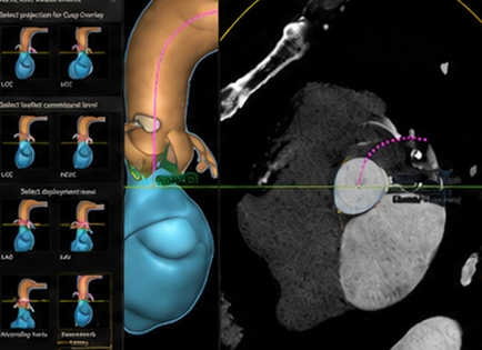 HeartNavigator